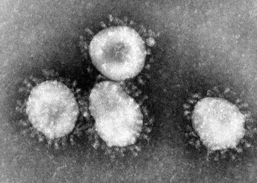 Profesor del IPN presenta síntomas de Coronavirus