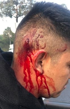 Auxilia SSC a lesionado de bala en Periférico