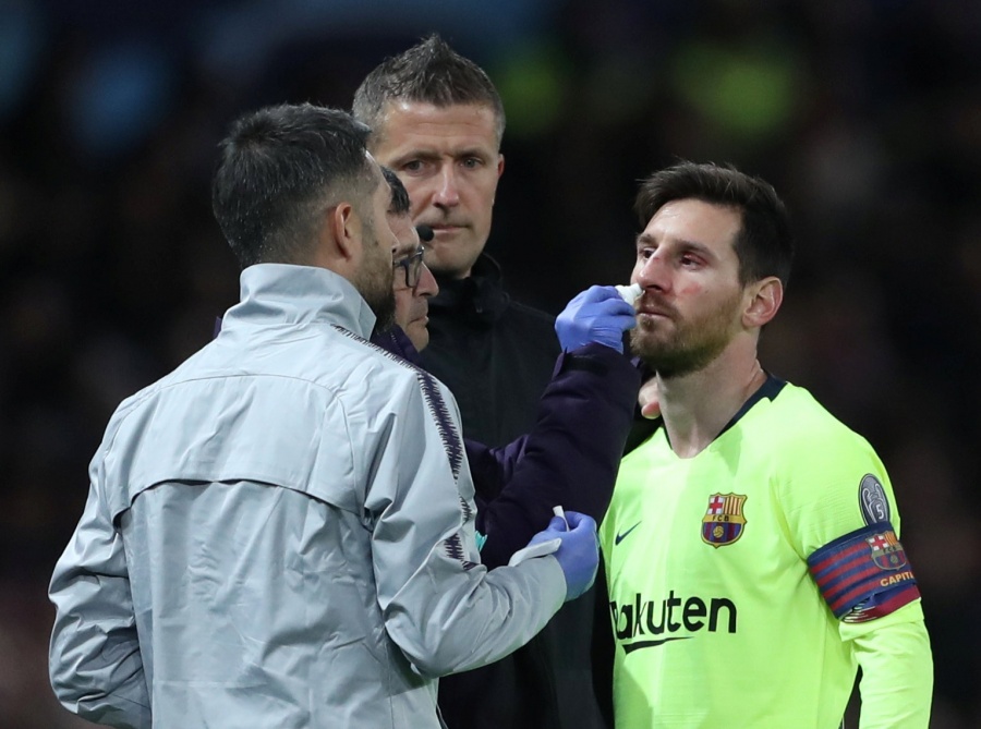 Descartan fractura nasal de Lionel Messi