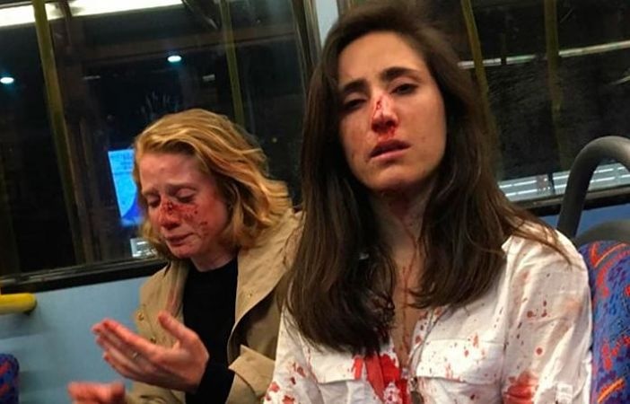 Pareja de lesbianas sufre agresión homófoba en autobús de Londres