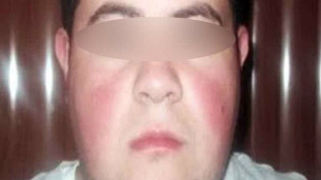 Detienen a “El Tomate”, en Azcapotzalco