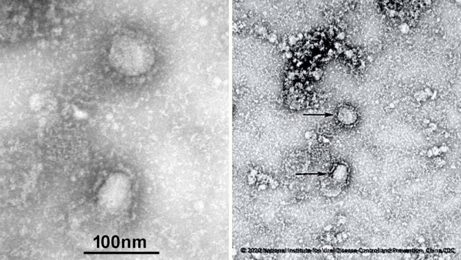 Científicos revelan primeras imágenes de Coronavirus