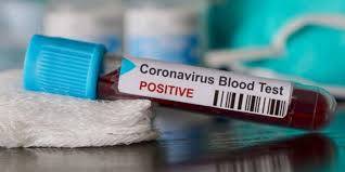 Confirman primer caso de coronavirus en Irlanda del Norte