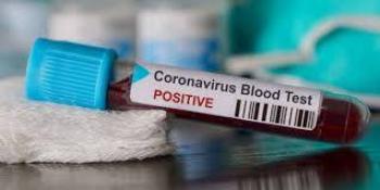 Confirman primer caso de coronavirus en Irlanda del Norte
