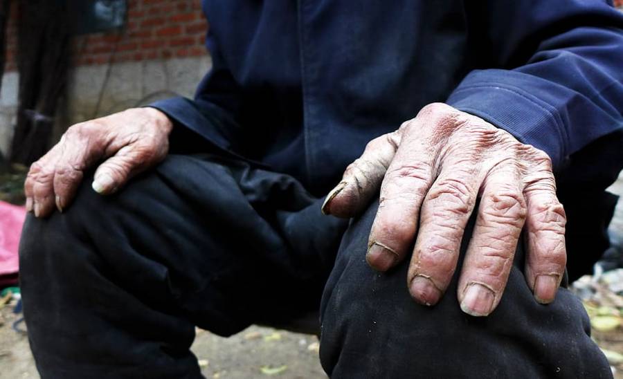 Hombre de 100 años de edad se cura de coronavirus