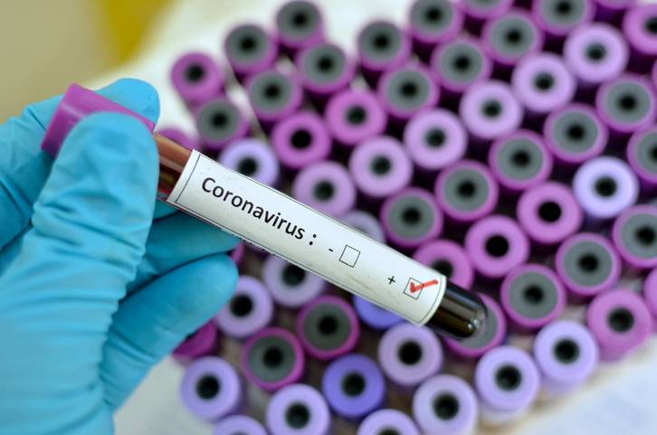 Da positivo a prueba de coronavirus un Funcionario de Educación en Puebla