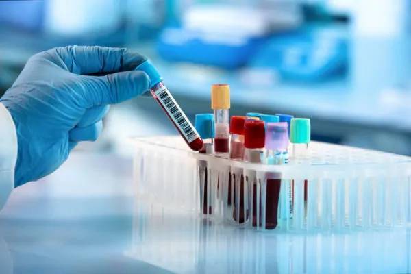 Cient&iacute;ficos de todo el mundo trabajan para tener vacuna contra coronavirus