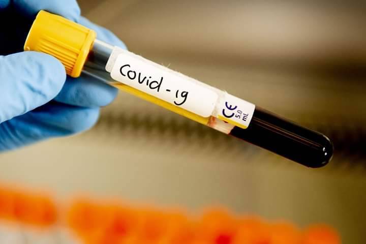 Más de 100 mil casos de Covid-19 en Estados Unidos