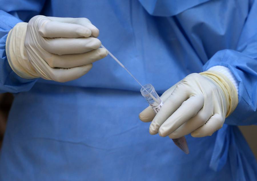 Rusia envía pruebas para coronavirus a más de 30 países