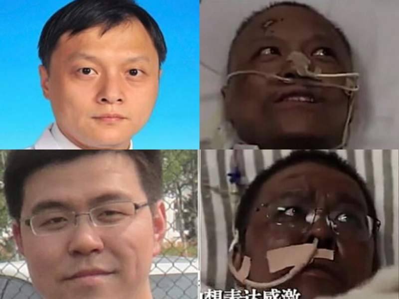 Un fuerte oscurecimiento de piel ocurre en dos médicos chinos de Wuhan