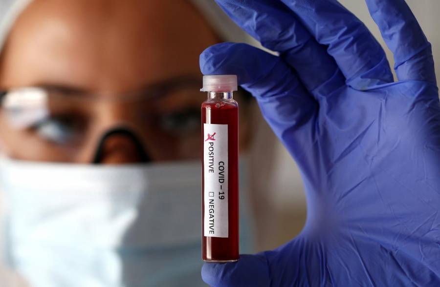Estudio confirma vulnerabilidad de grupo sanguíneo A ante coronavirus