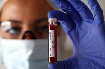 Estudio confirma vulnerabilidad de grupo sangu&iacute;neo A ante coronavirus