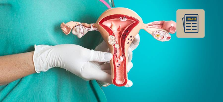 Cáncer de ovario, una enfermedad sigilosa para la mujer mexicana