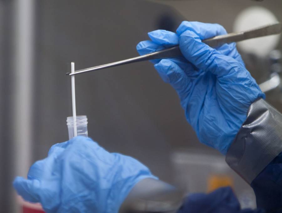 UAM en b&uacute;squeda de biomarcadores epigen&eacute;ticos para tratar Covid-19