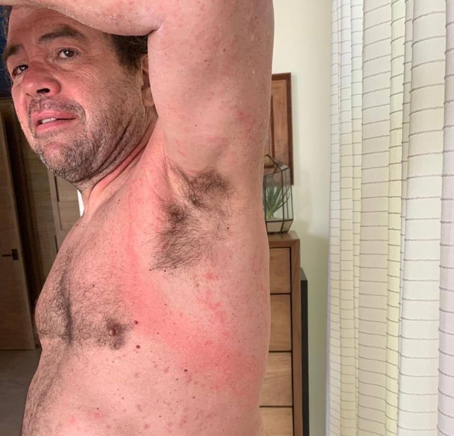 Antonio Arguelles es picado por medusas durante entrenamiento en Mar de Cort&eacute;s