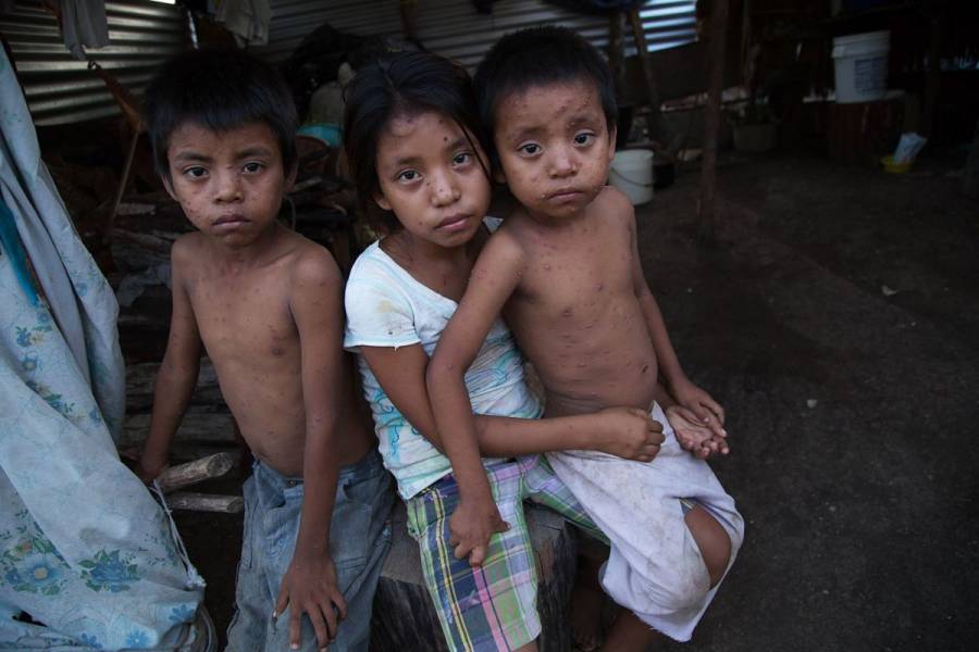 Pandemia aumenta la desnutrición en América Latina y el Caribe