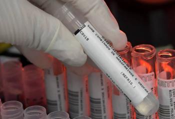 Brasil registra m&aacute;s de 23 mil casos en un d&iacute;a