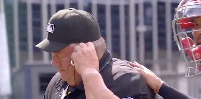 Batazo provoca hemorragia en umpire en el Nacionales-Azulejos