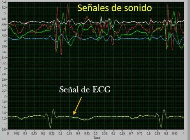 ESTUDIANTE DEL IPN DESARROLLA SISTEMA PARA DETECTAR FALLAS CARDIACAS