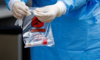 Registran la primera muerte por reinfecci&oacute;n de Covid-19 en el mundo