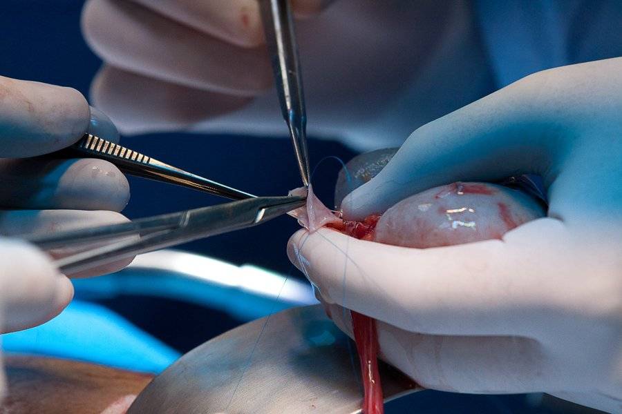 Procuración multiorgánica del IMSS Querétaro beneficia a más de 200 personas