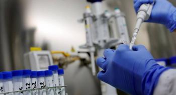 M&aacute;s de 6 mil casos de brucelosis han sido diagnosticados en China