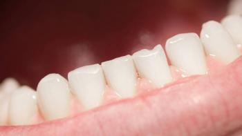COVID-19 podr&iacute;a provocar la ca&iacute;da de dientes, reporta NYT