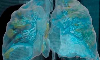 Revelan estudios da&ntilde;o hasta luego de tres meses en pulmones de quienes tuvieron Covid