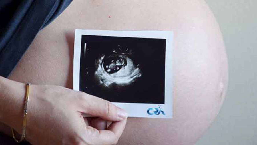 Considerar preservaci&oacute;n de &oacute;vulos recomiendan para mujeres que no han sido madres
