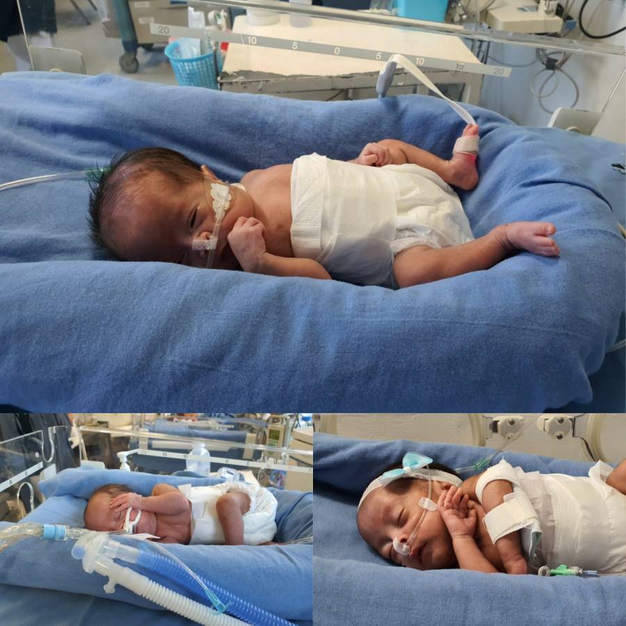 Nacen trillizas en el Hospital Juárez De México