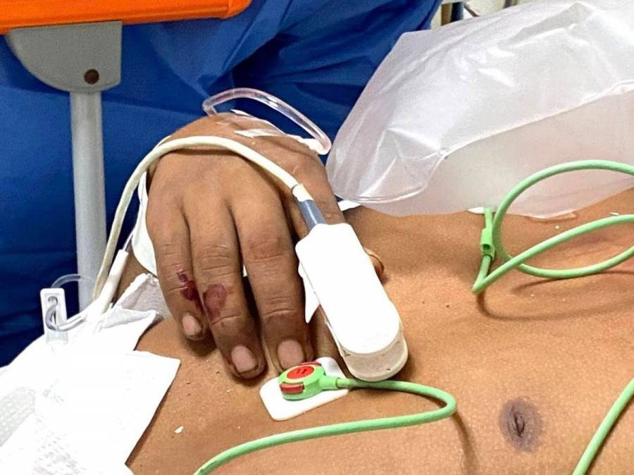 Asciende a 56 la cifra de migrantes muertos por accidente en Chiapas