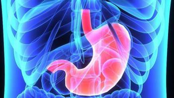 C&aacute;ncer de est&oacute;mago en sus primeras etapas es curable, informaron cient&iacute;ficos