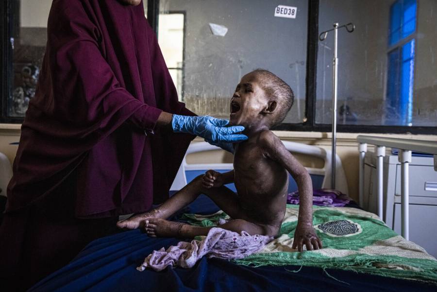 La ONU advierte de riesgo de hambruna en Somalia