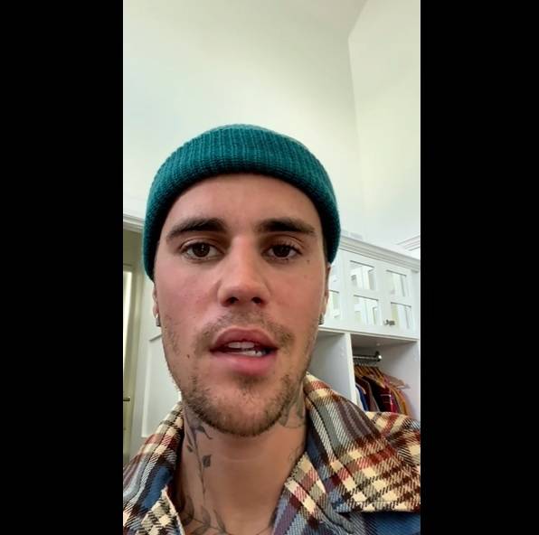 Justin Bieber dice padecer una parálisis facial parcial