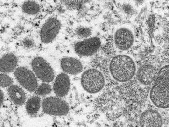 OMS planea compartir vacunas contra viruela del mono fuera de &Aacute;frica