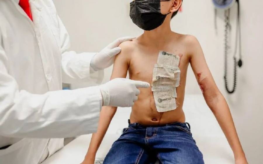 Con injerto de piel cultivada, IMSS Chiapas ayuda a recuperación de pacientes quemados