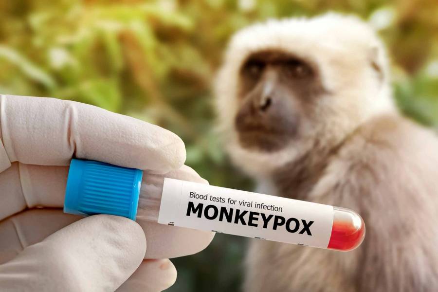 Urge prevenci&oacute;n ante la viruela del mono en M&eacute;xico