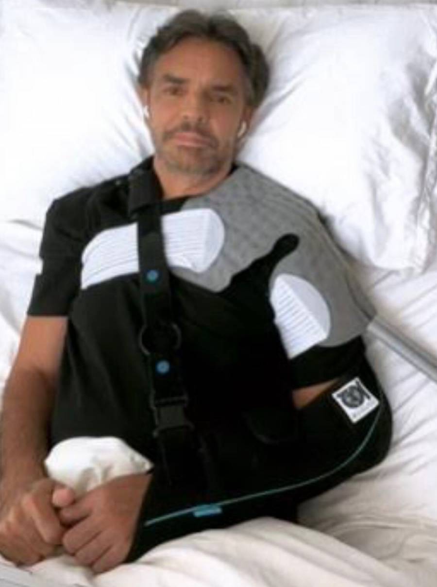 Eugenio Derbez asegura que su recuperación podría tardar hasta un año