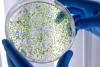 Salud emite alerta epidemiol&oacute;gica por c&oacute;lera