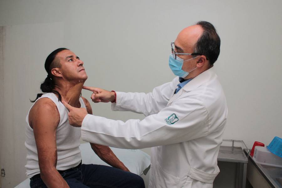 Educación temprana previene accidentes por quemaduras en niños y adolescentes: IMSS