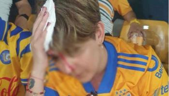 AFICIONADA DE TIGRES SALIÓ HERIDA POR FRAGMENTO DE CONCRETO QUE SE DESPRENDIÓ DEL ESTADIO UNIVERSITARIO EN PLENO PARTIDO