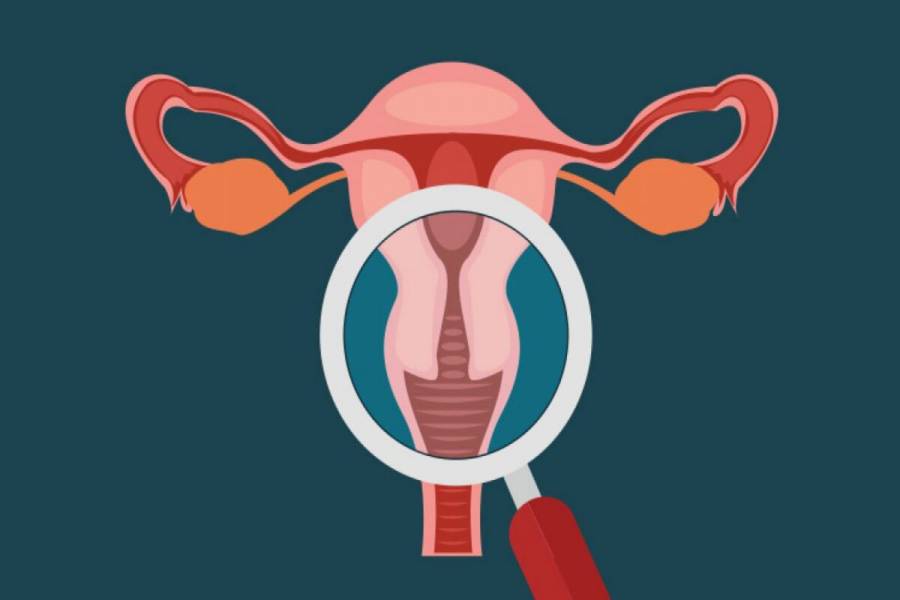 INCan atiende mil 700 mujeres con programa Micaela contra cáncer cervicouterino
