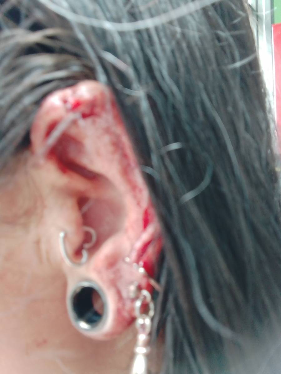 Mujer es agredida por un hombre en el Metrobús de la CDMX y sigue impune