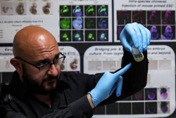 Cient&iacute;ficos crean estructuras similares a embri&oacute;n humano sin esperma ni &oacute;vulos