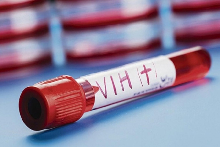 Implante recargable, un avance revolucionario en la prevenci&oacute;n del VIH