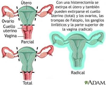 Cirug&iacute;a rob&oacute;tica y laparosc&oacute;pica ofrecen nuevas opciones para las mujeres