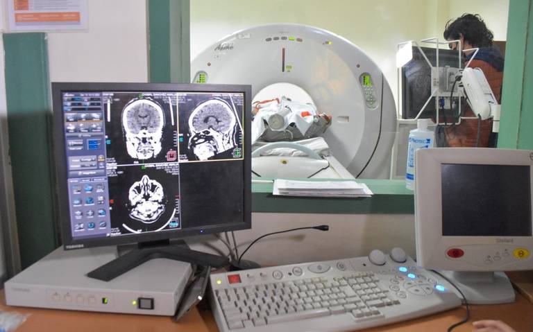 Busca Secretaría de Salud atender problemas cerebrales en Edomex