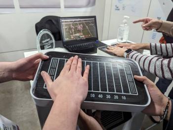 Un guante de alta tecnolog&iacute;a frena temblores del mal de Parkinson
