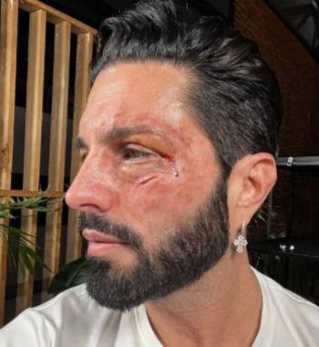 La historia detr&aacute;s de las impactantes fotos de Poncho De Nigris