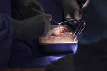 Primer trasplante de un ri&ntilde;&oacute;n de cerdo a un paciente vivo